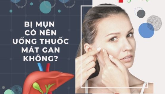 Bị mụn có nên uống giải độc gan hay không ?